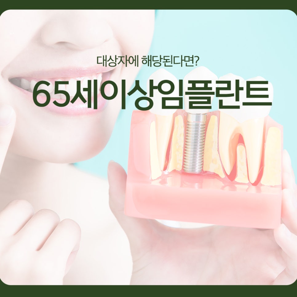 Implants for Those Aged 65 and Over: Are You Eligible? image 1