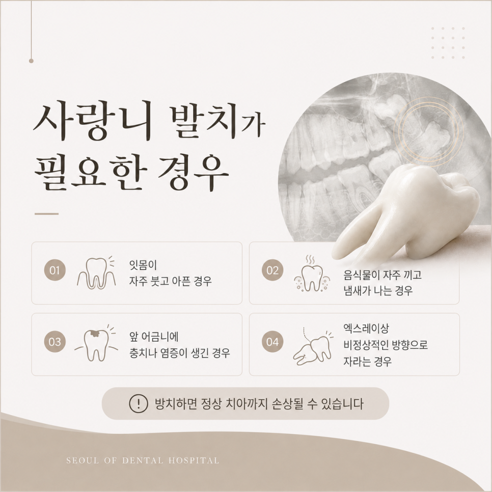 Samjeon Station Dental Clinic: Do Wisdom Teeth Have to Be Removed? Cases Where Extraction Is Necessary image 4