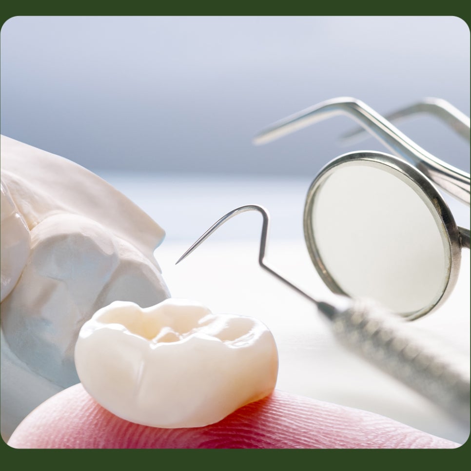 Crown loosening: if you can feel it and there’s a smell, what does it mean? image 5