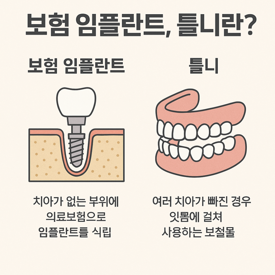 If Your Denture Keeps Coming Loose, What Should You Do? A Real Case Solved with Insurance-Covered Implant Dentures image 1