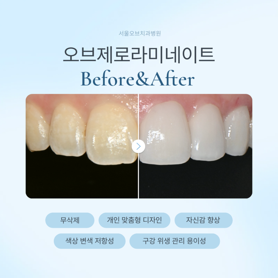 Key Criteria to Know Before Comparing Laminate Prices | OBZERO image 1