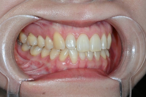 Why Obzero Laminates Look Naturally Beautiful image 9