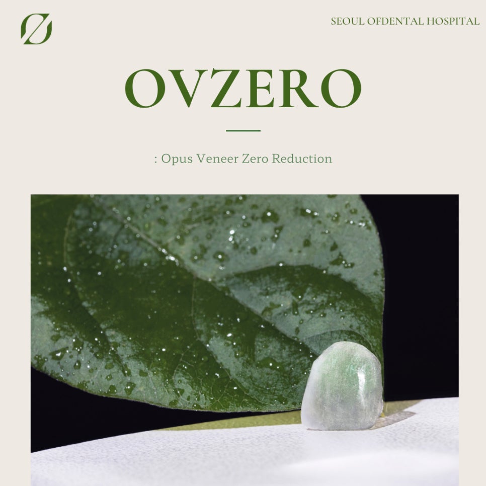 Why Obzero Laminates Look Naturally Beautiful image 2