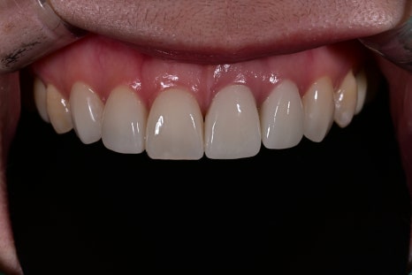 Key Criteria to Know Before Comparing Laminate Prices | OBZERO image 22