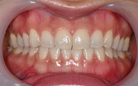 OVZERO Laminate: What Makes It Different? image 7