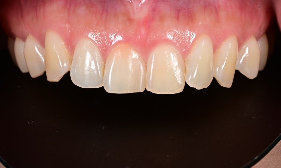 Laminates Price, Zero-Reduction Laminates with Ovzero image 9