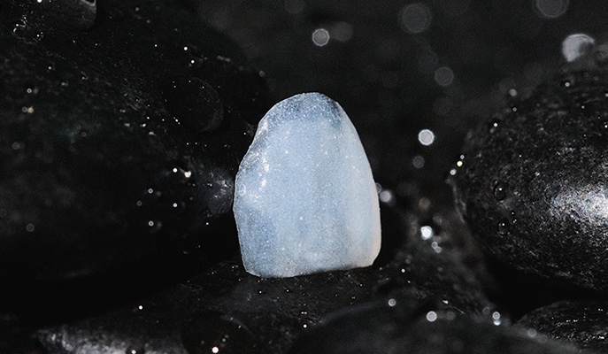 Front Tooth Laminate Veneers Are Natural Even at 70 — A Senior OVZERO Treatment Case image 4