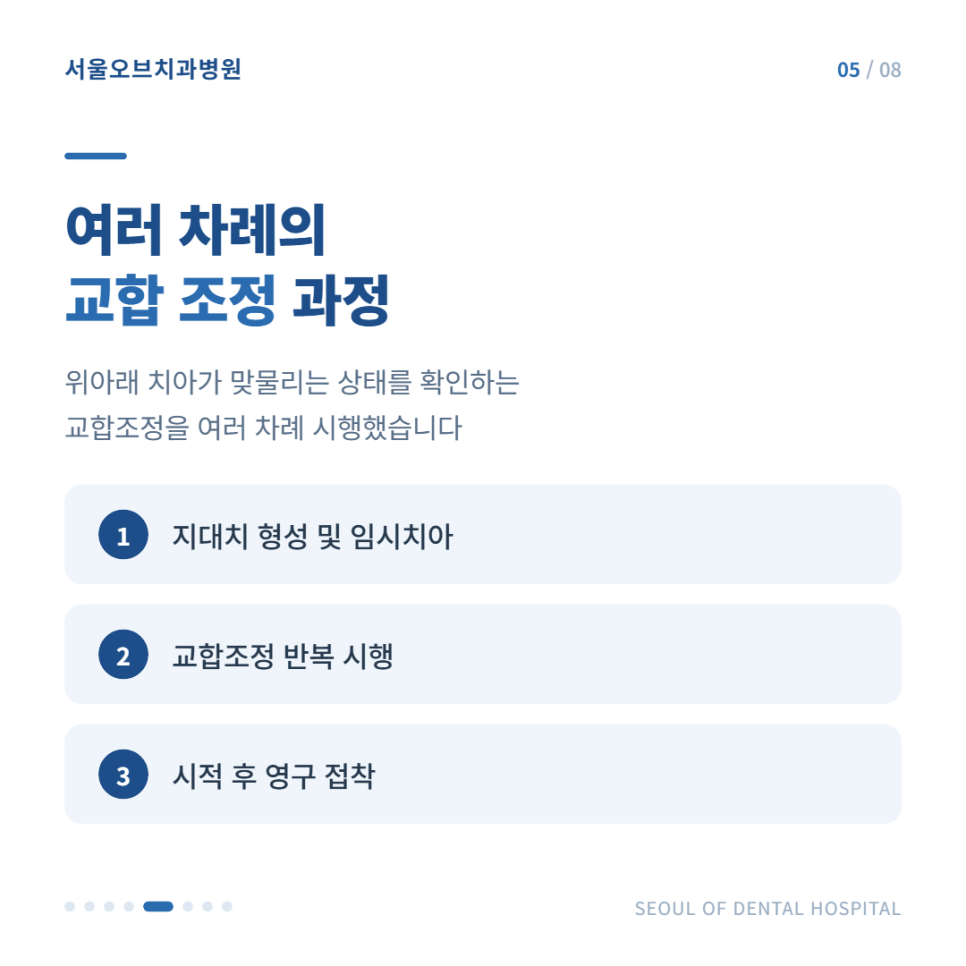 오브제로 라미네이트로 앞니 변색 고민 해결한 실제 사례 관련 이미지 16