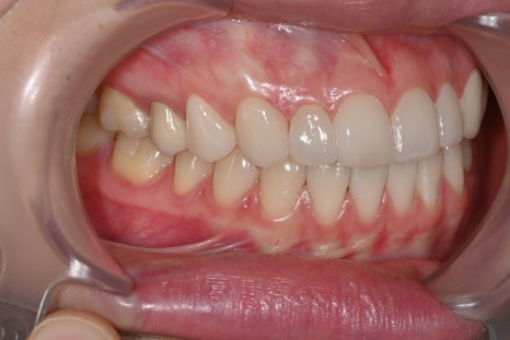 OVZERO Laminate: What Makes It Different? image 9