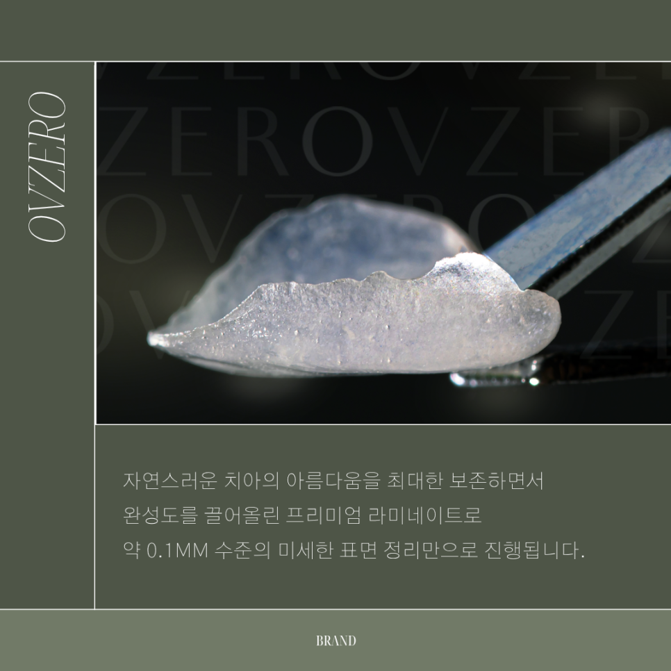 오브제로라미네이트, 무삭제라미네이트 라미네이트치과 선택 기준 관련 이미지 2