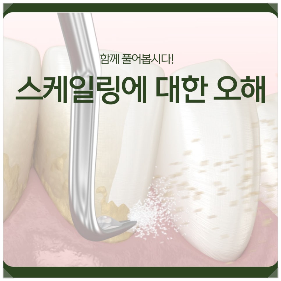 Let’s Clear Up Misconceptions About Scaling Together! image 1