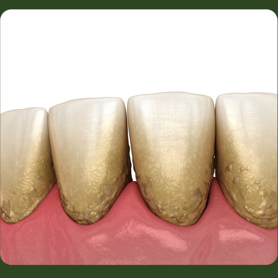 Scaling Frequency: Let’s Learn Together and Keep Up with Regular Visits! image 2