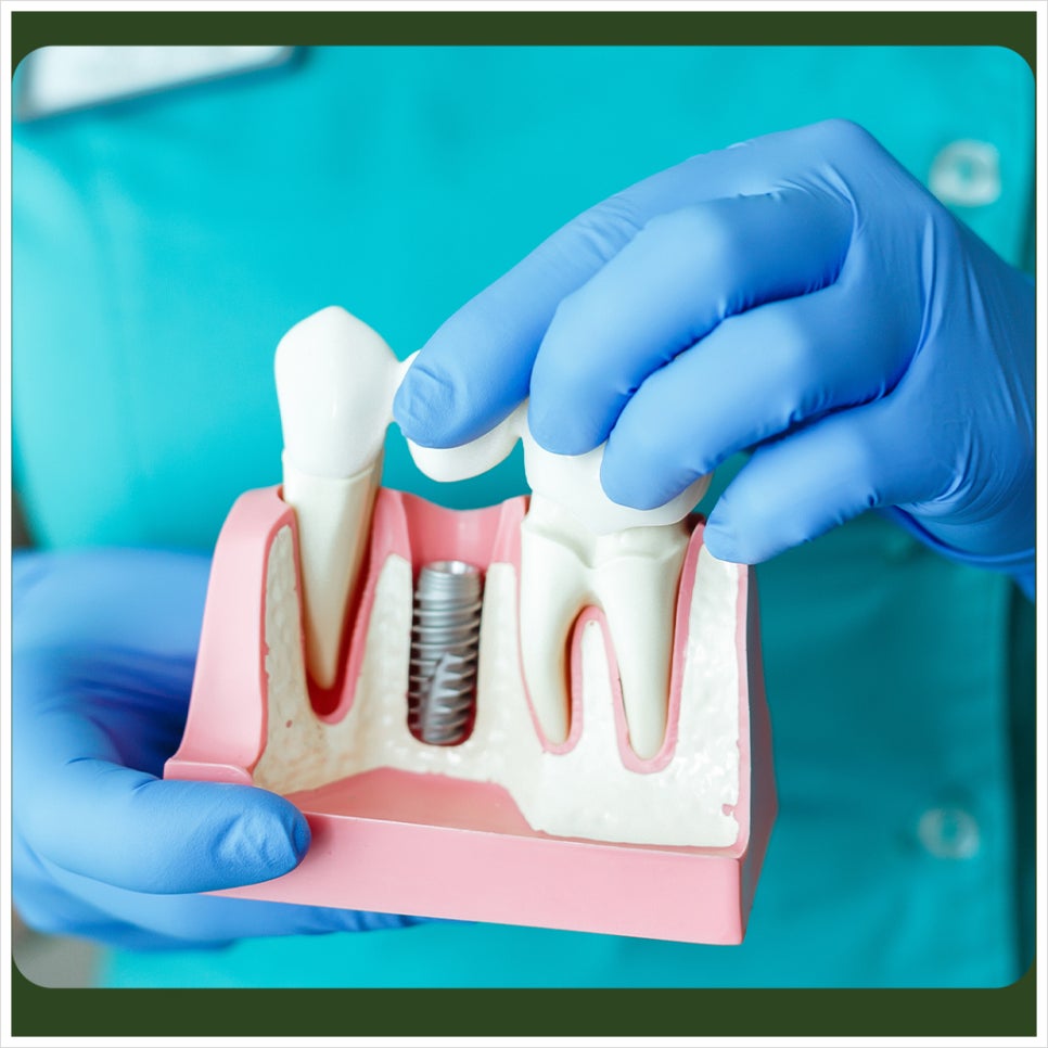 Implant Bleeding Control: When Does the Bleeding Stop? image 2