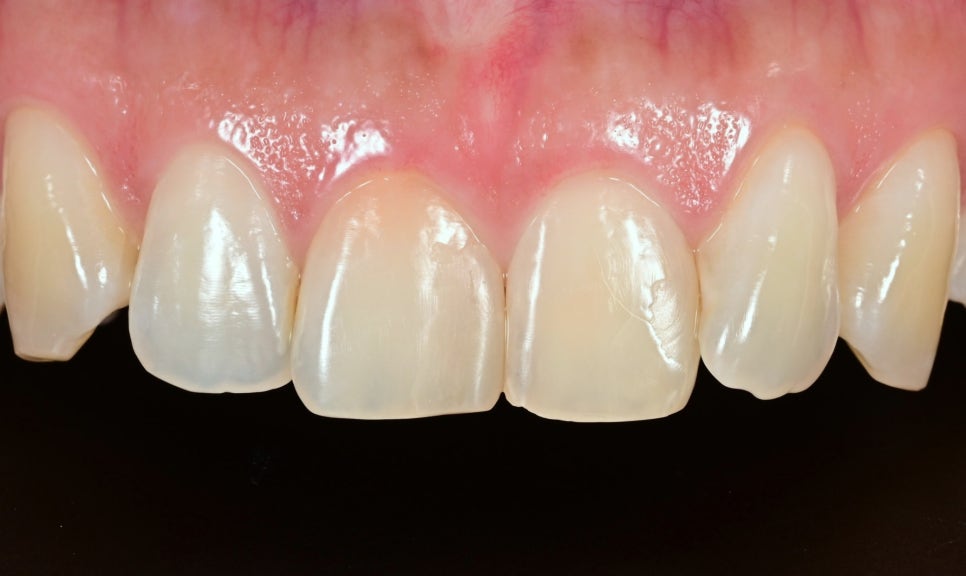 The Money to Open Two Dental Clinics, We Spent It on an ‘In-House Dental Laboratory’ image 3