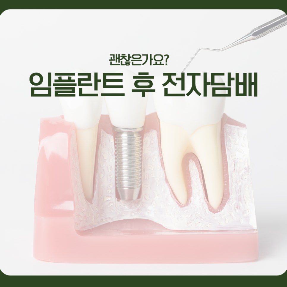 임플란트 후 전자담배, 괜찮은가요? 관련 이미지 1