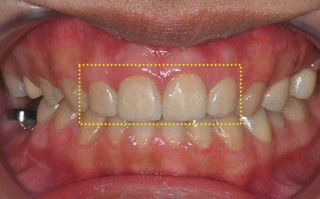 [Seokchon Station Dental Clinic] Overcoming Dental Phobia with Evening and Sunday Treatment! image 10