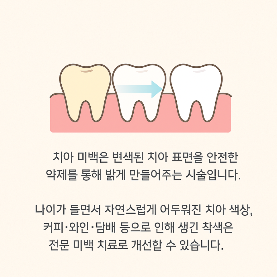 Tone Up Your Teeth in Just One Day! A Whitening Treatment Review at Seoul Of Dental image 1