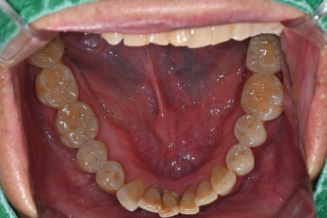 Sedation Dentistry for Those Who Find Scaling Difficult, Seoul Of Dental Hospital image 2