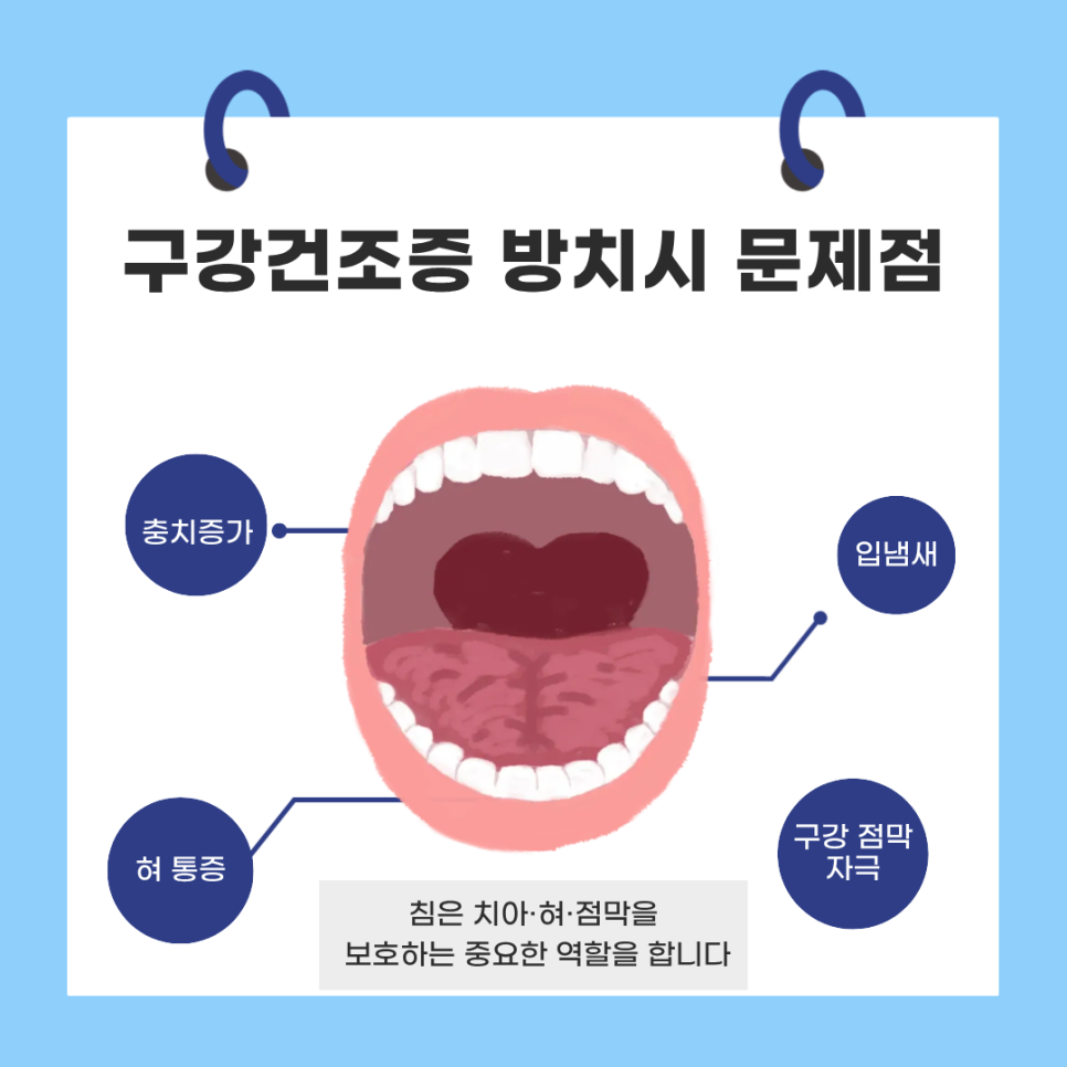 Dry Mouth Is Not Just Thirst — It May Be a “Condition” image 9