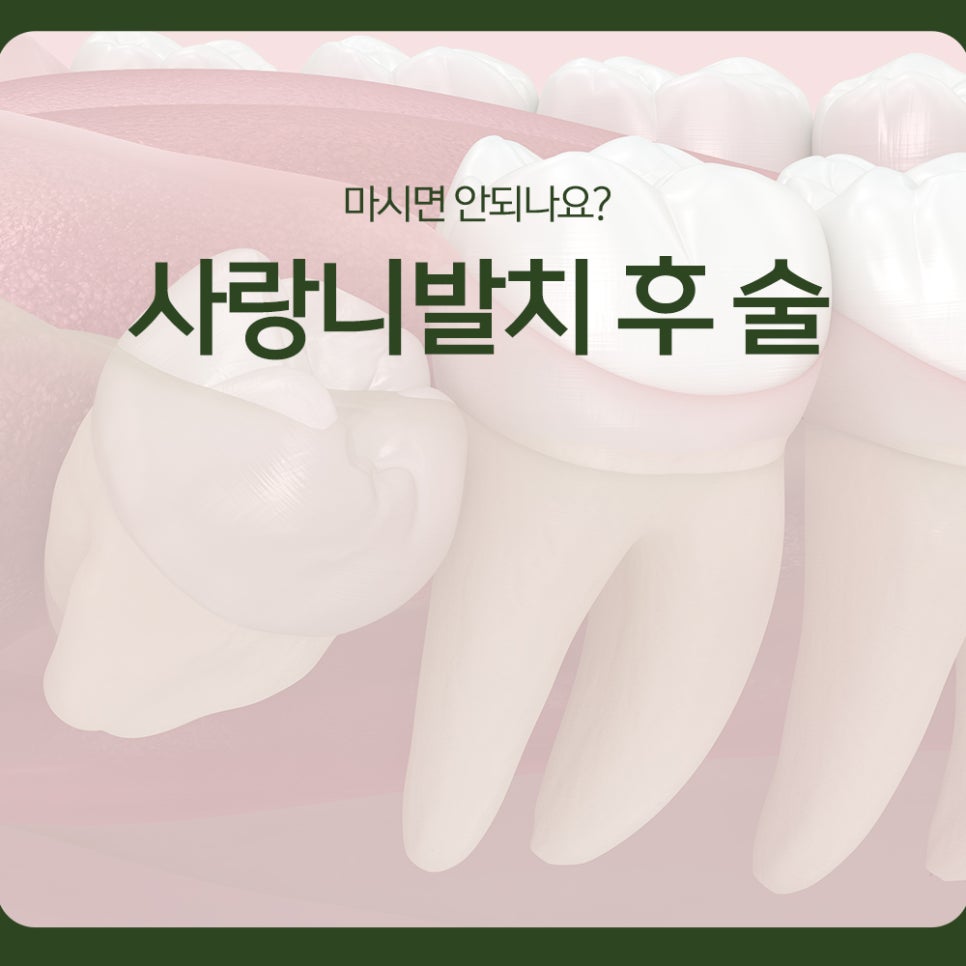 Can I Drink Alcohol After Wisdom Tooth Extraction? image 1