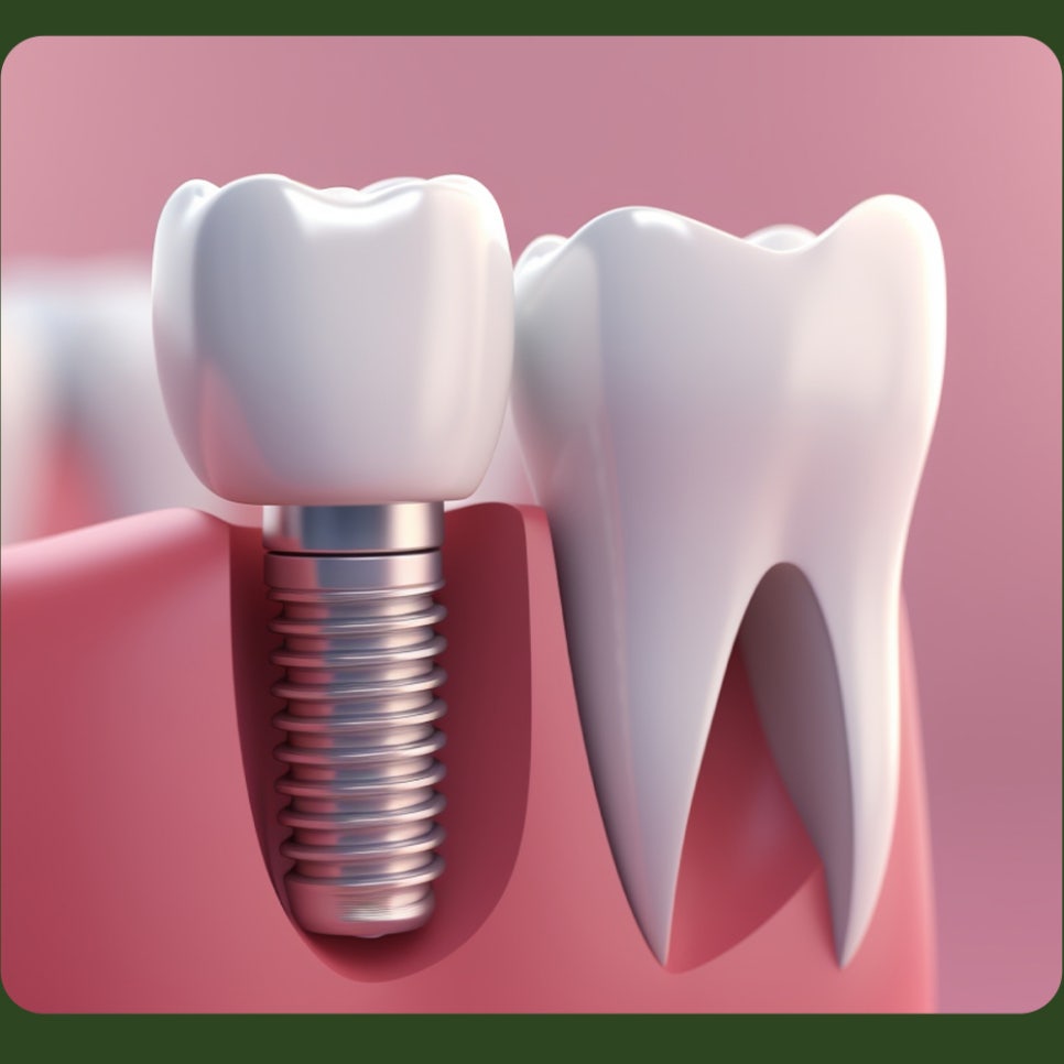 Post-Implant Care Instructions—Let’s Take a Look Together! image 4