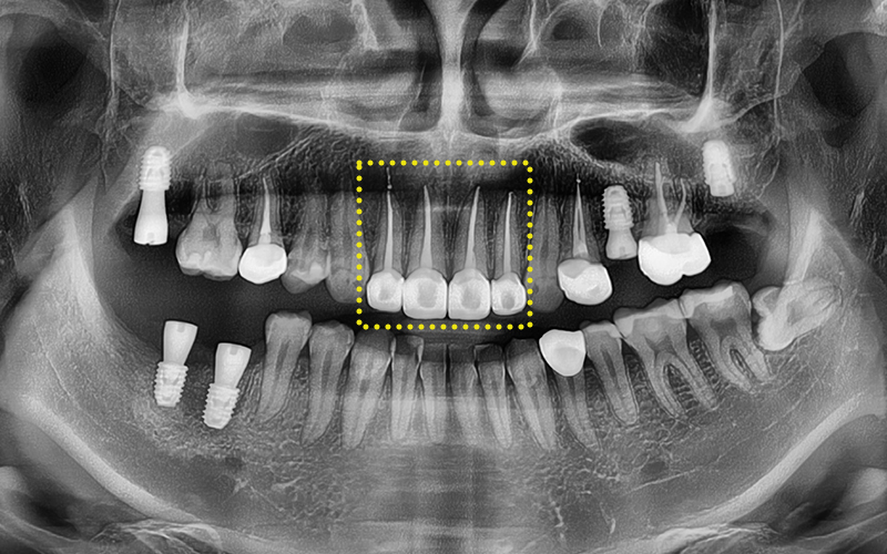 [Seokchon Station Dental Clinic] Overcoming Dental Phobia with Evening and Sunday Treatment! image 12