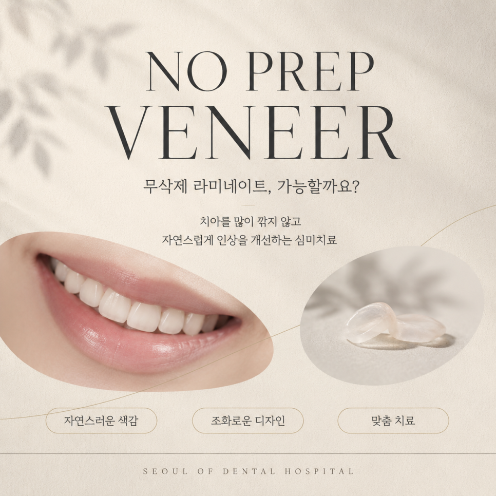 Treatment with Objetto Laminate Veneers After a Chipped Front Tooth image 6