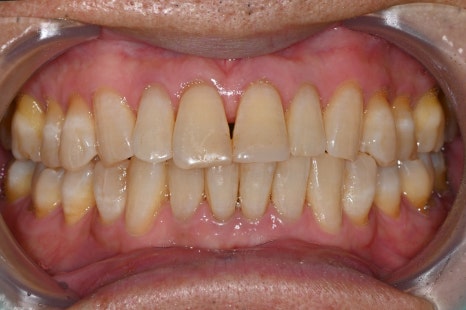 Sedation Dentistry for Those Who Find Scaling Difficult, Seoul Of Dental Hospital image 1