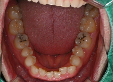 Found a Dental Clinic That Can See Patients on Sundays! Convenient for Patients with Rhinitis and Asthma image 3