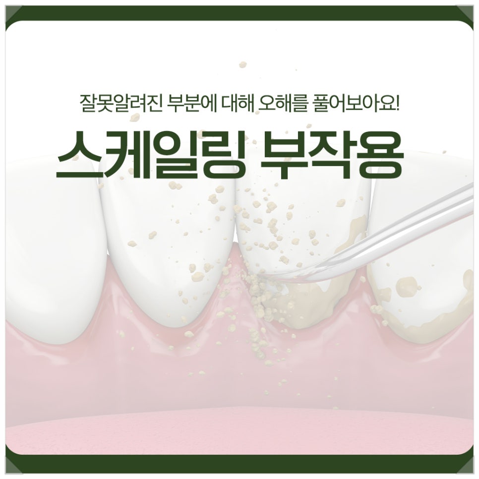 스케일링 부작용, 잘못알려진 부분에 대해 오해를 풀어보아요! 관련 이미지 1