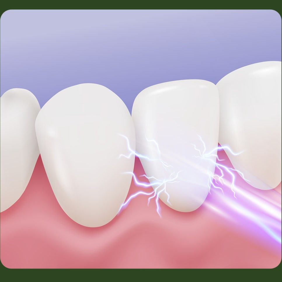 Causes of Tooth Sensitivity: What If It Hurts with Cold Water and Cold Wind? image 3