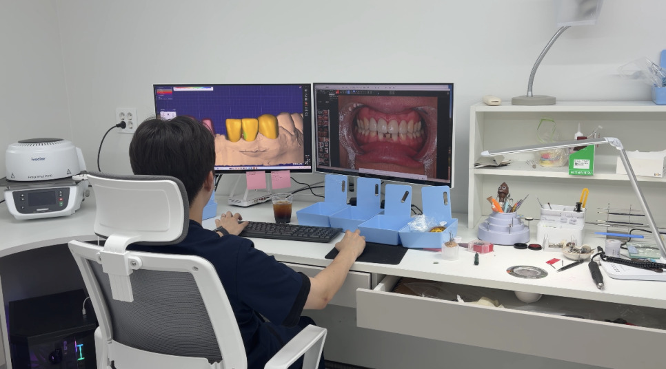 The Money to Open Two Dental Clinics, We Spent It on an ‘In-House Dental Laboratory’ image 9