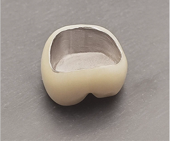 Jamsil Dental Clinic Zirconia Crown Price image 3