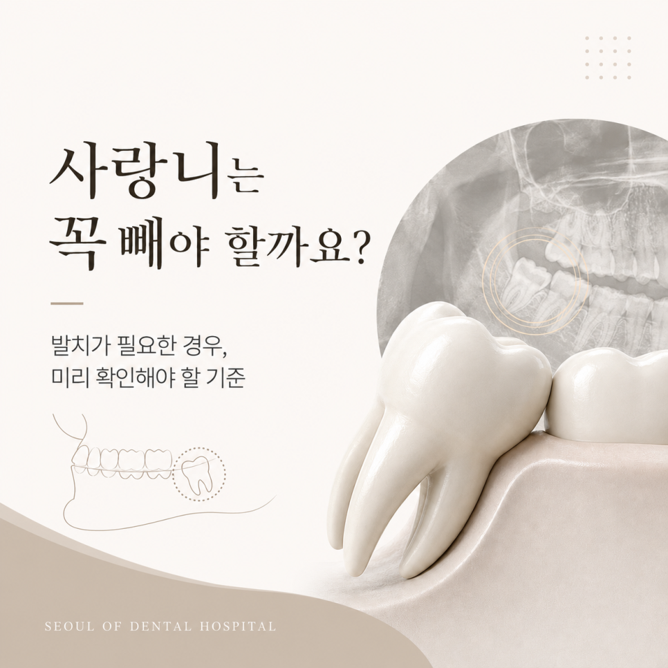 Samjeon Station Dental Clinic: Do Wisdom Teeth Have to Be Removed? Cases Where Extraction Is Necessary image 1