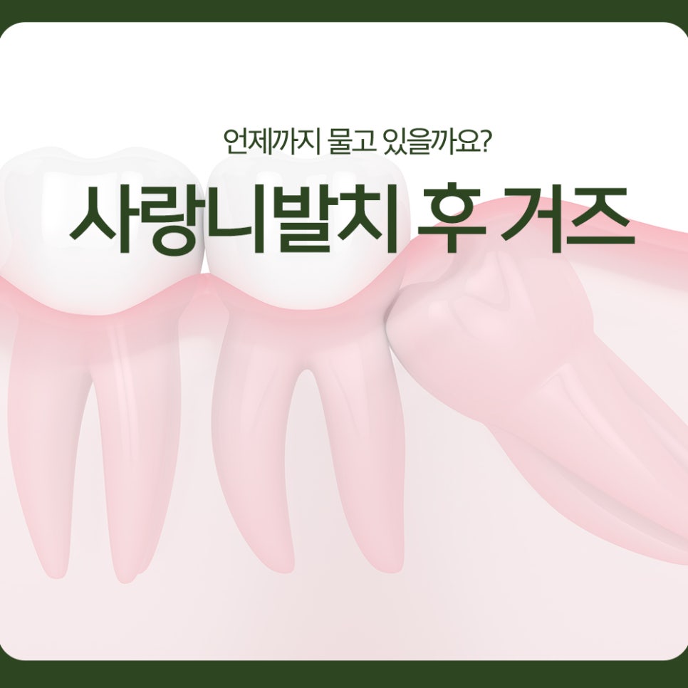 After Wisdom Tooth Extraction, How Long Should You Keep Biting on the Gauze? image 1