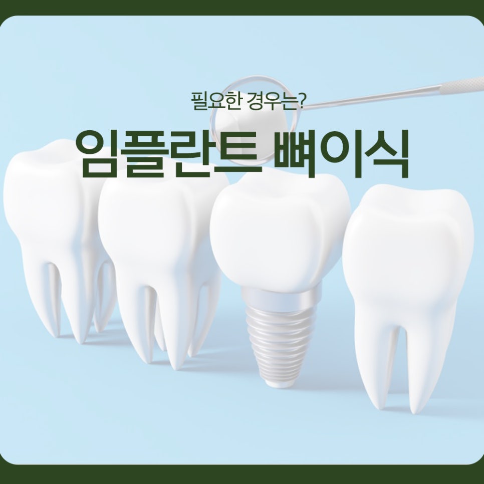 When Is Bone Grafting Needed for Implants? image 1