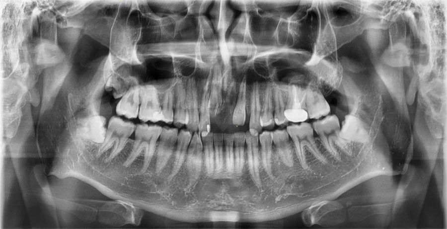 Recommended Ways to Get Hospital Treatment and Compensation After a Traffic Accident image 7