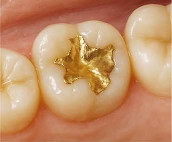 The Power to Protect Natural Teeth: Seoul Orbe Dental Hospital’s Philosophy of Conservative Treatment image 10