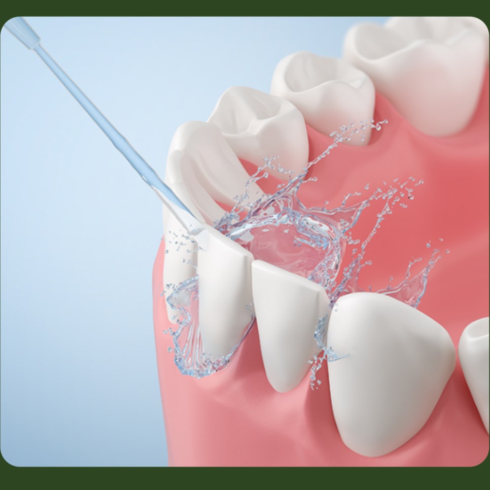 Waterpik Usage: Let’s Learn and Make Use of It Together! image 3