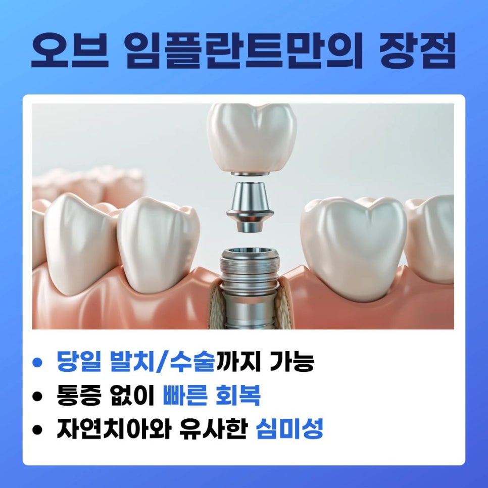 Songpa Dental Clinic: Implant After Molar Extraction image 17