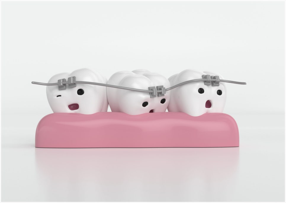 Concerned About Gaps Between Your Front Teeth? image 5