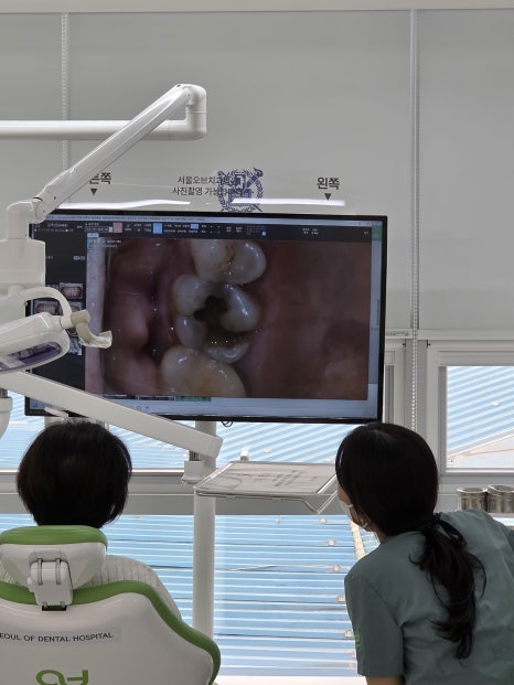 When a molar breaks, do you always need an implant? image 5