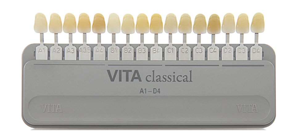 Wedding D-14, It’s Time for Whitening Now!🦷 image 5