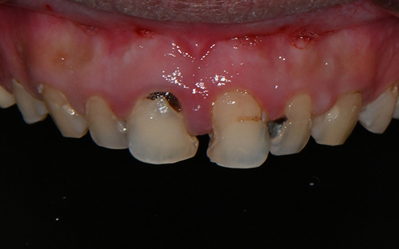 [Seokchon Station Dental Clinic] Overcoming Dental Phobia with Evening and Sunday Treatment! image 7