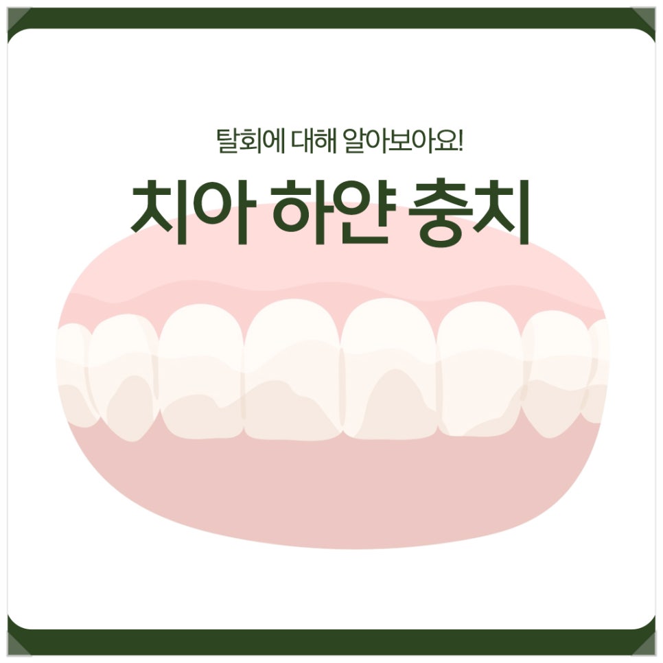 치아 하얀 충치, 탈회에 대해 알아보아요! 관련 이미지 1
