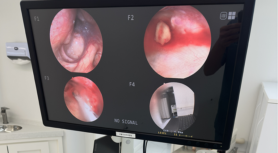 The Power to Protect Natural Teeth: Seoul Orbe Dental Hospital’s Philosophy of Conservative Treatment image 2