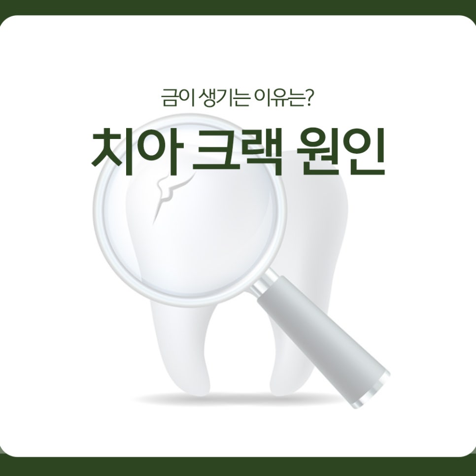 What Causes Tooth Cracks? Why Do They Form? image 1