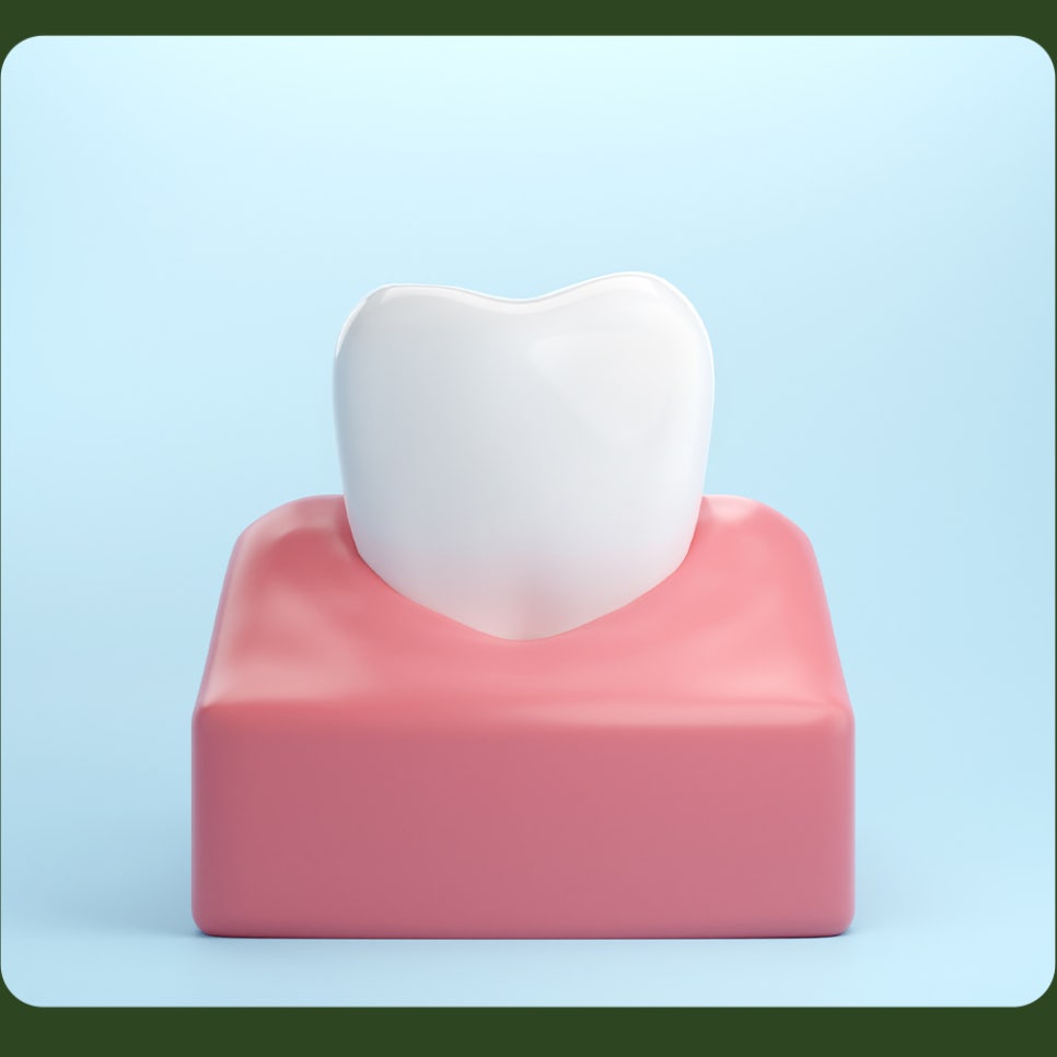 What Causes Tooth Notching, and How Is It Treated? image 5