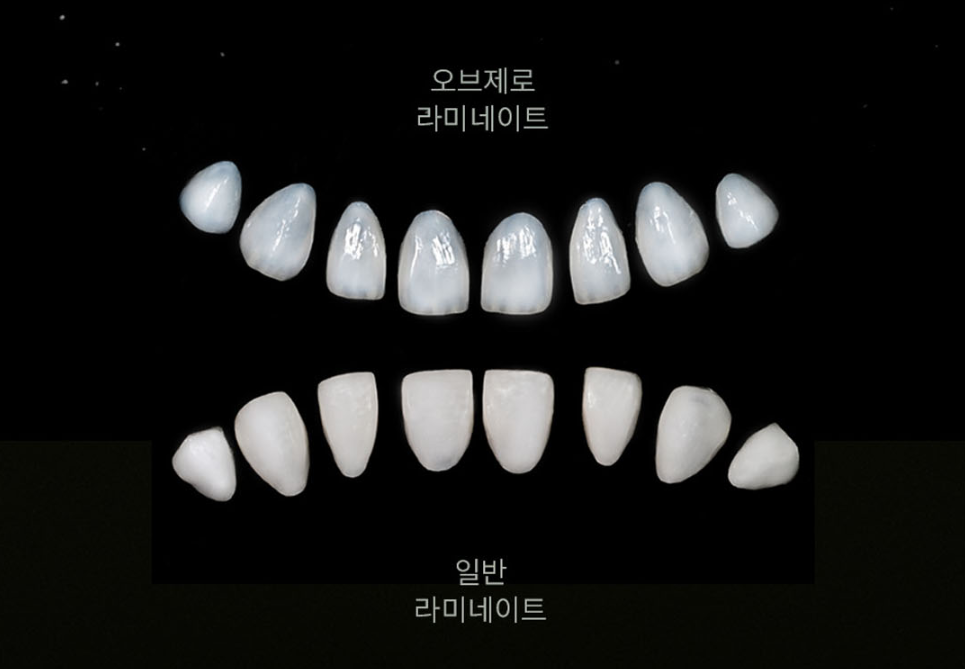 무삭제 라미네이트 종류별 차이 총정리 — 제로 라미네이트, 뭐가 다를까? 관련 이미지 2