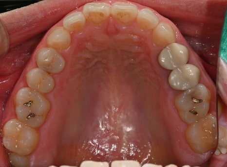 Found a Dental Clinic That Can See Patients on Sundays! Convenient for Patients with Rhinitis and Asthma image 2